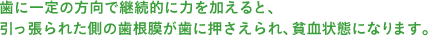 歯に一定の方向で継続的に力を加えると、引っ張られた側の歯根膜が歯に押さえられ、貧血状態になります。