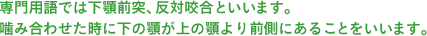 専門用語では下顎前突、反対咬合といいます。噛み合わせた時に下の顎が上の顎より前側にあることをいいます。